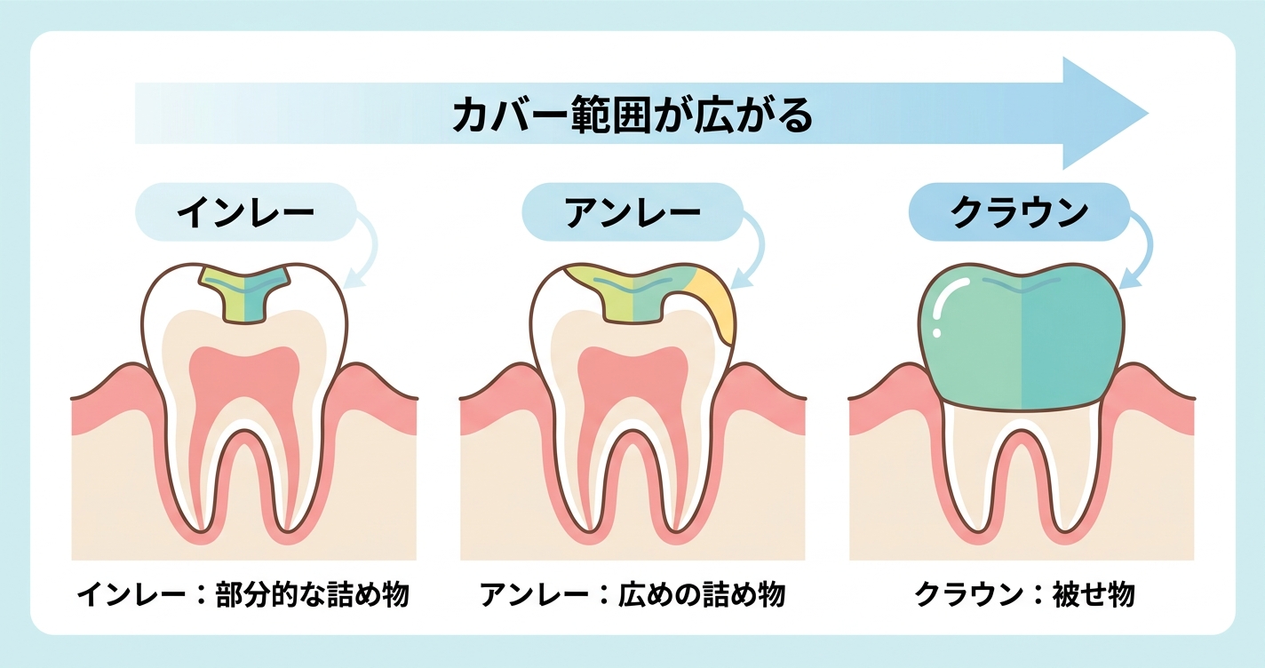 ■インレー・アンレー・クラウンとは？詰め物・被せ物の基本を整理