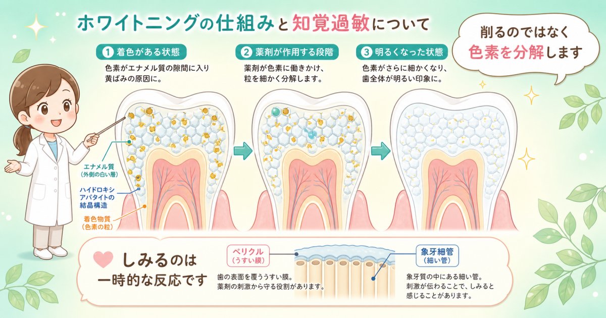 ホワイトニングでエナメル質が傷むのは本当か？漂白の仕組みと誤解