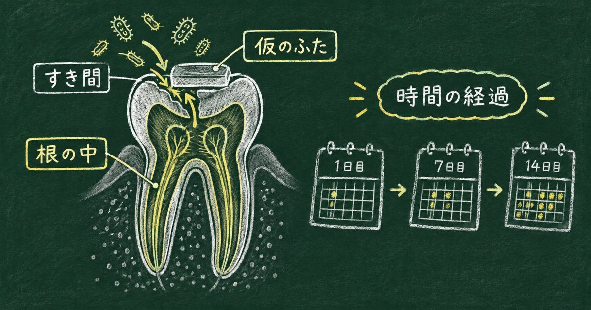 根の治療を途中でやめるリスクとは？痛みが消えても受診すべき理由