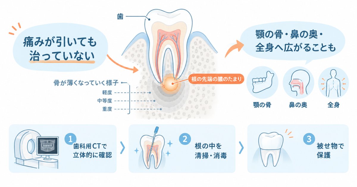歯の根の膿は放置で治る？痛みがなくても骨や全身に及ぶ影響と治療法
